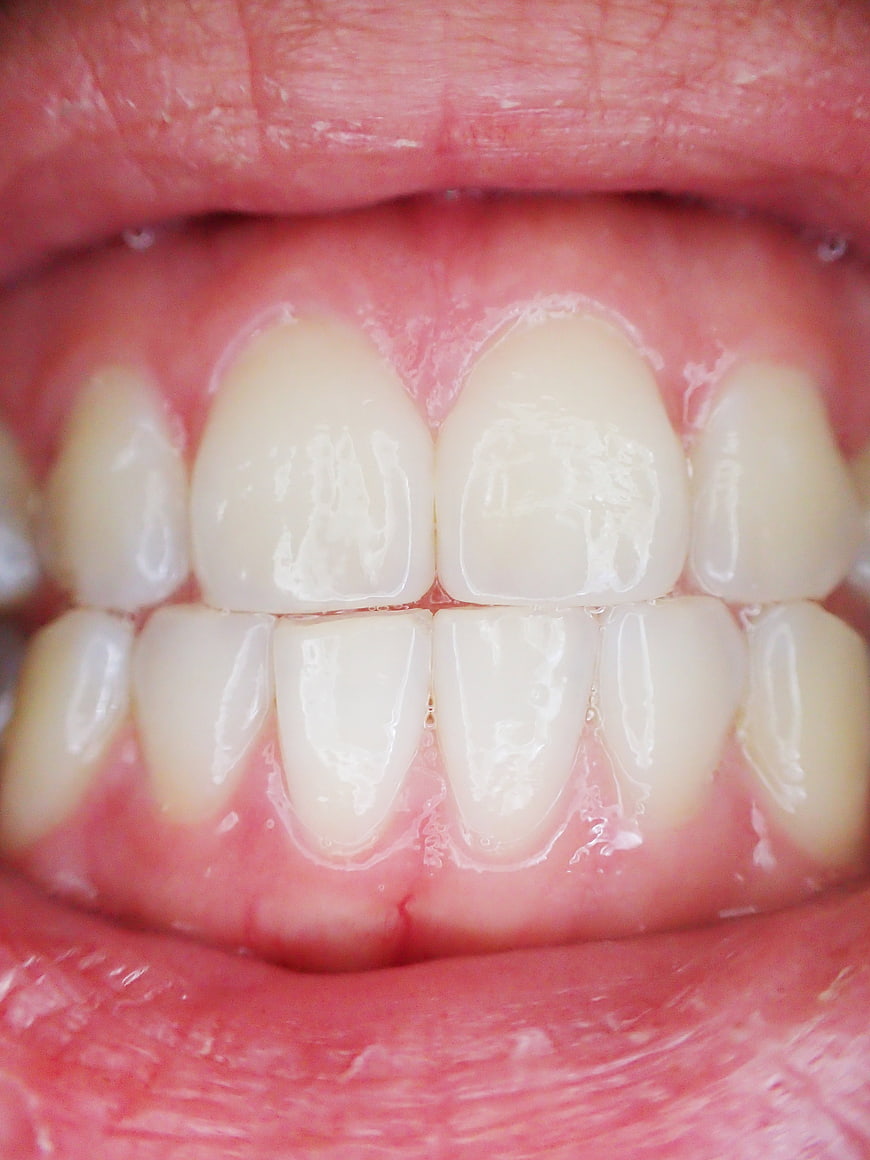 Close-up of healthy human teeth and gums