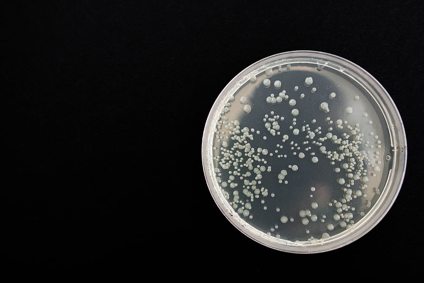 Bacterial colonies in petri dish on black background