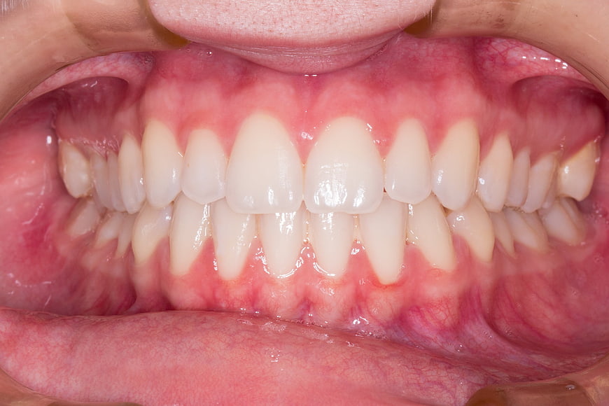 Close-up of human teeth and gums dental examination