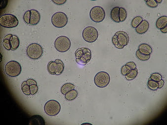 Microscopic View of Sea Urchin Embryo Cell Division