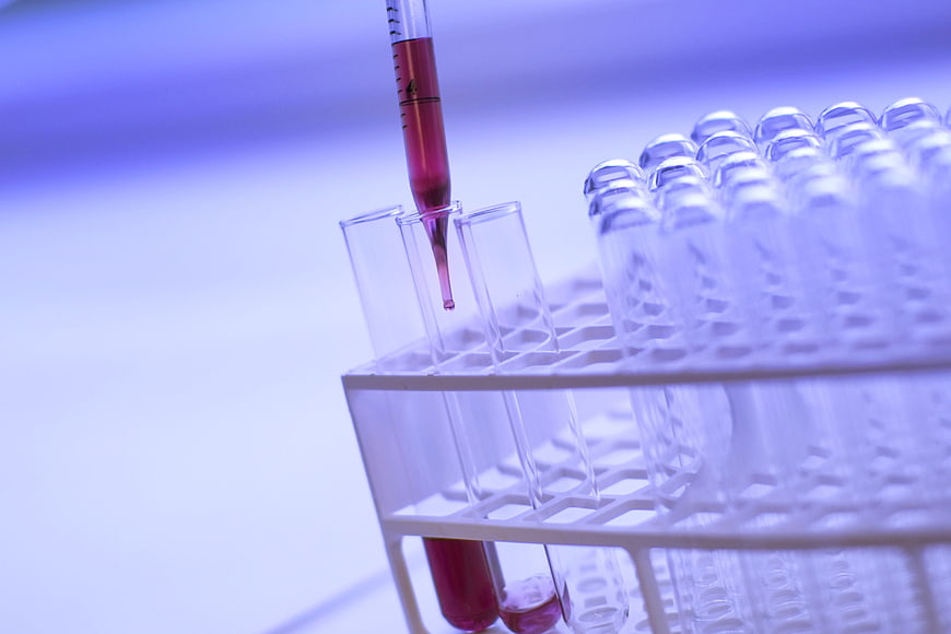 Pipette Dropping Red Liquid into Test Tube in Lab