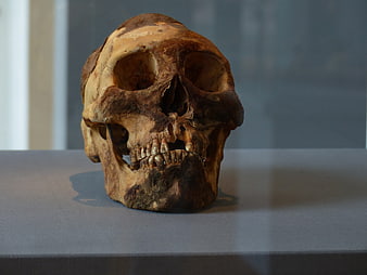 Ancient Human Skull in Museum Display Case