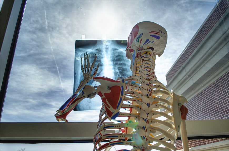 Colorful anatomical skeleton model holding x-ray film