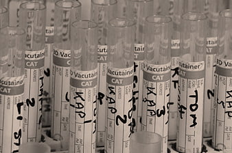Close-up of labeled medical vacutainer tubes in laboratory rack
