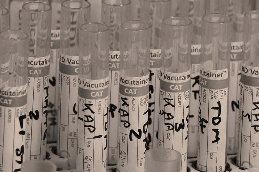 Close-up of labeled medical vacutainer tubes in laboratory rack