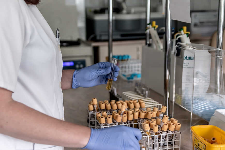 Lab Technician Examining Blood Sample in Test Tube
