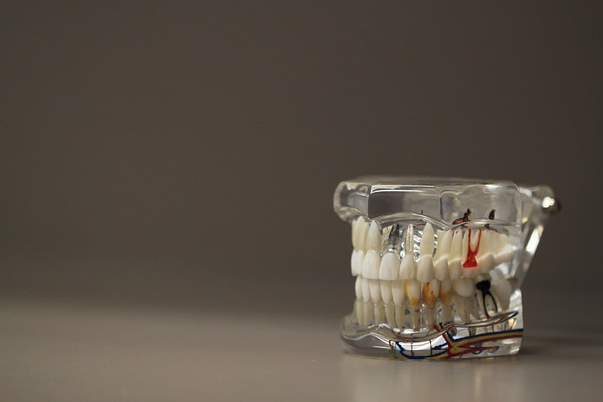 Transparent Dental Model with Teeth and Nerves