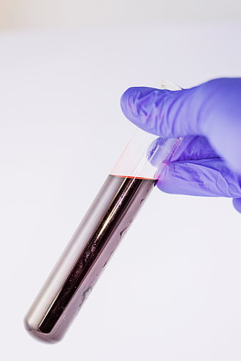 Gloved Hand Holding Blood Sample Test Tube
