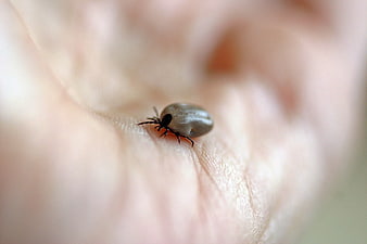 Macro close-up of a tick on human skin