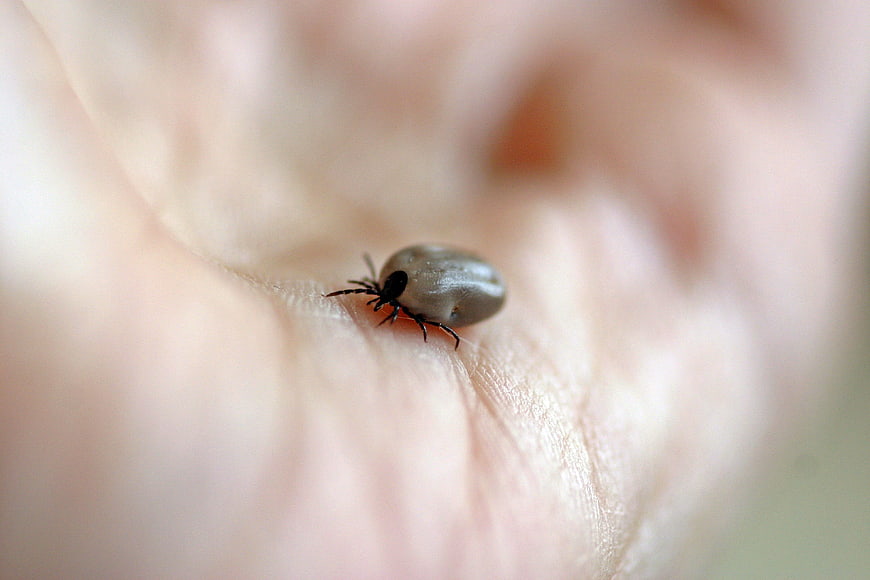 Macro close-up of a tick on human skin