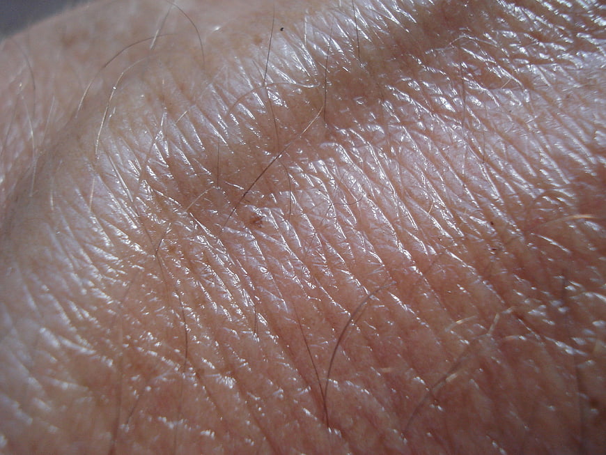 Macro Close-Up of Human Skin Texture and Fine Hair