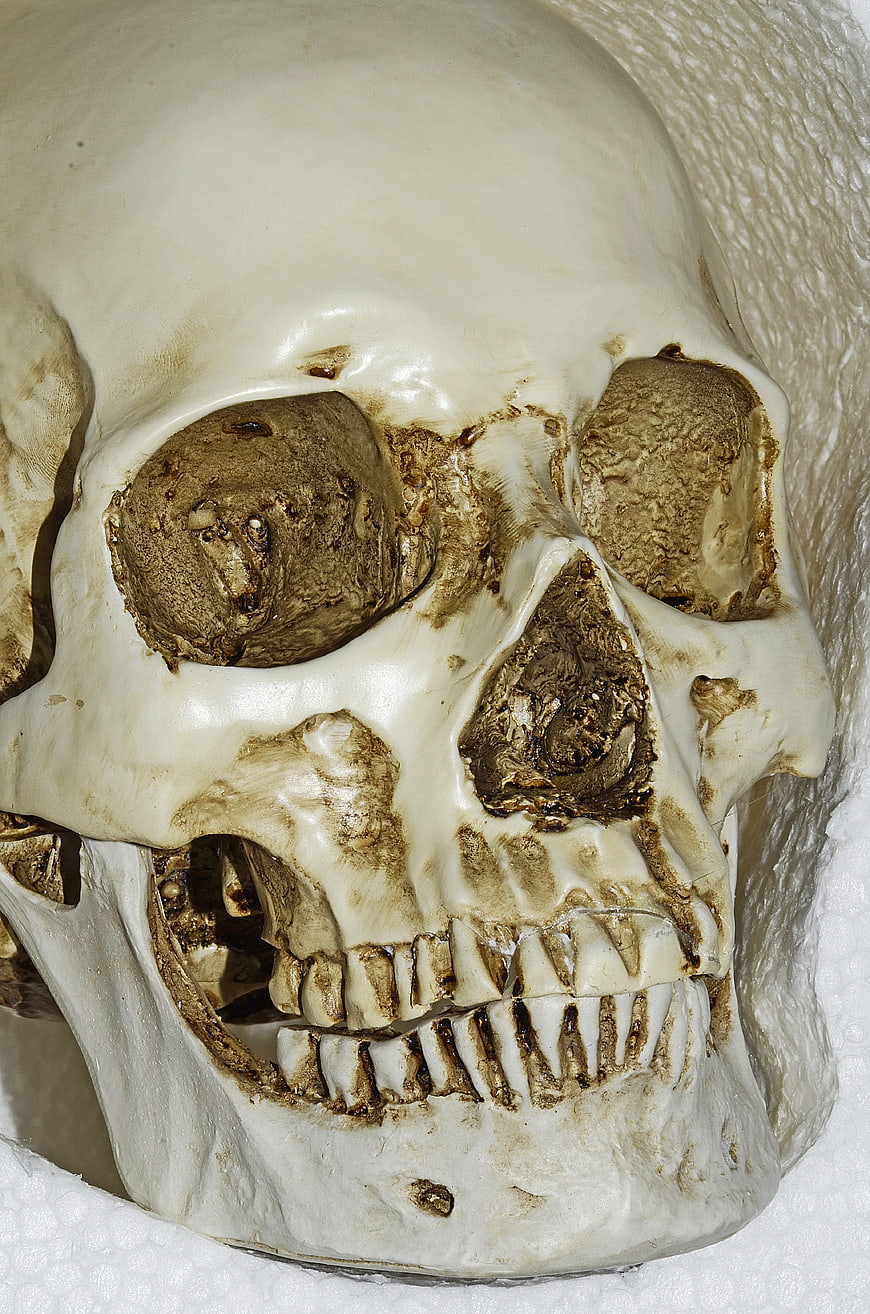 Close-up of Human Skull with Visible Bone Texture