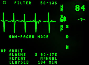 Green ECG Heart Monitor Display on Black Background