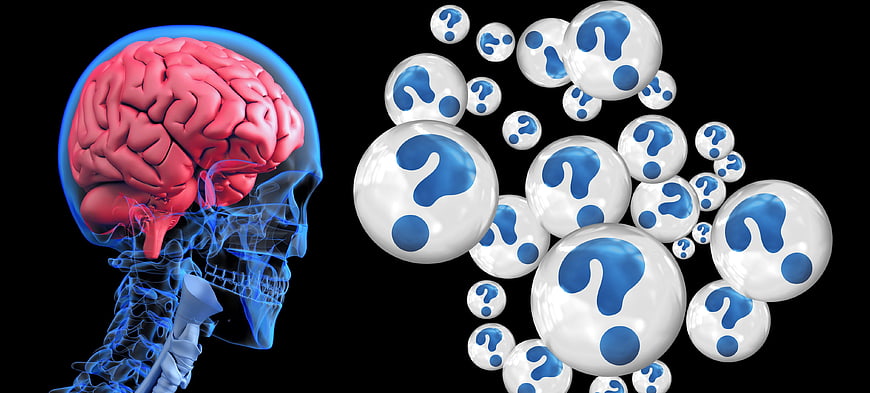 3D Brain Anatomy with Question Marks on Black Background