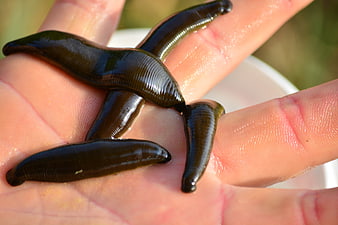 Close-up of medical leeches resting on a human hand