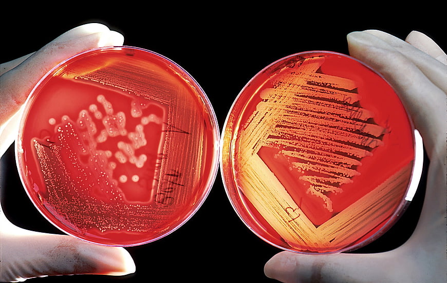Petri dishes with bacterial colonies on red agar