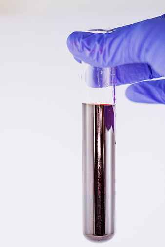 Gloved Hand Holding Test Tube with Blood Sample