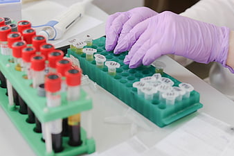 Scientist Handling Blood Sample Tubes in Laboratory Rack