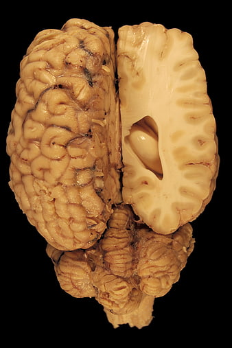 Horse Brain Anatomy Specimen with Cerebrum and Cerebellum
