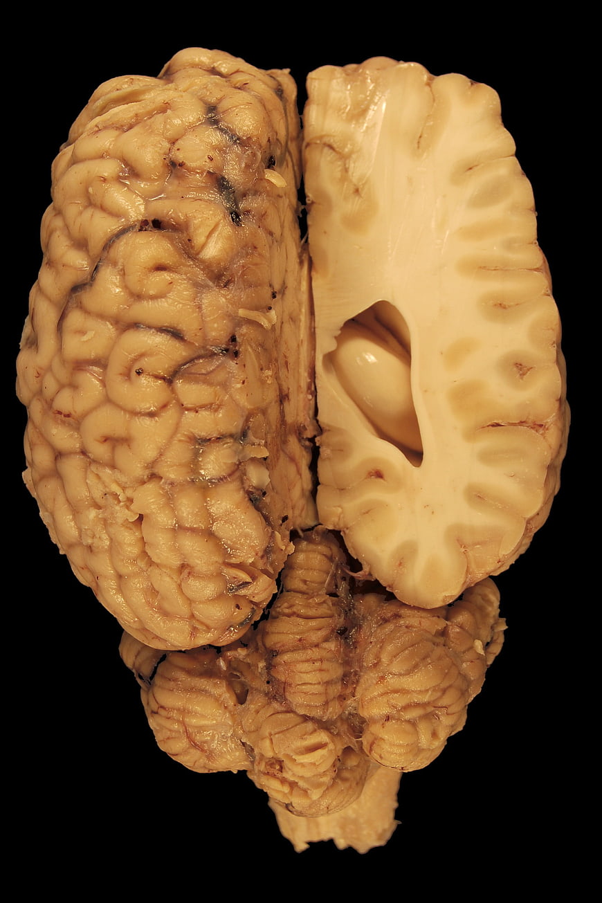 Horse Brain Anatomy Specimen with Cerebrum and Cerebellum