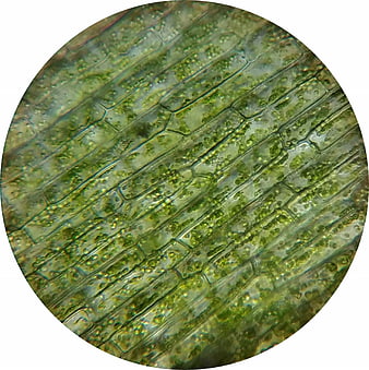 Microscopic view of waterweed plant cells with chloroplasts