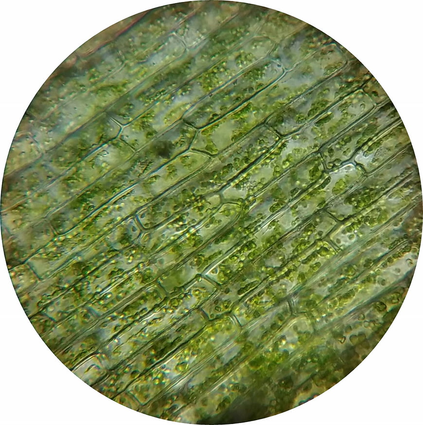 Microscopic view of waterweed plant cells with chloroplasts