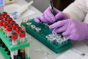 Scientist labeling blood sample tubes in a medical laboratory