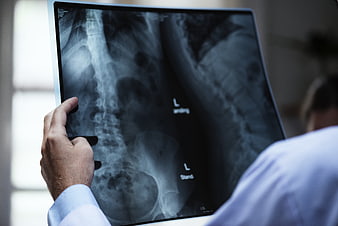Doctor examining spine X-ray film in medical office