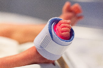 Newborn baby foot in medical support brace