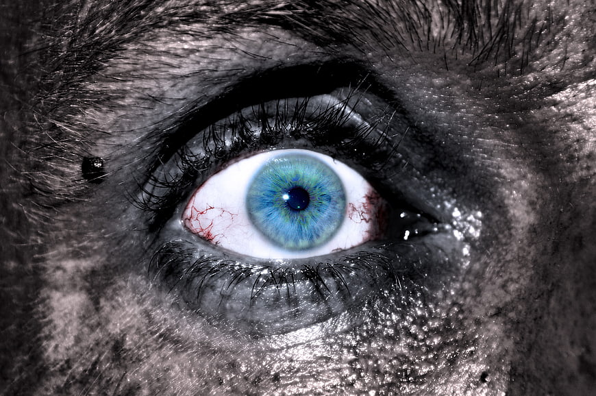 Extreme Close-Up of a Blue Eye with Red Veins on Decayed Skin
