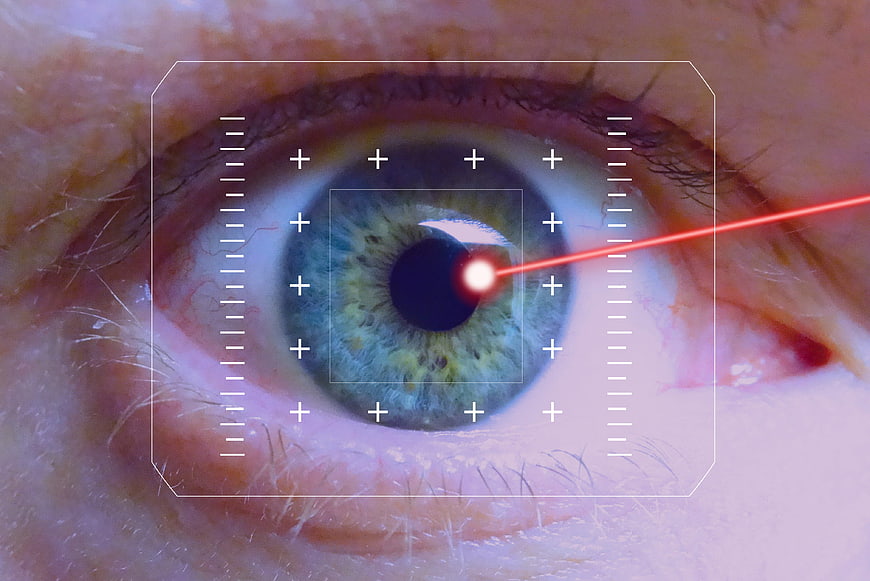 Close-up of eye undergoing laser vision correction surgery
