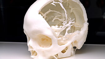 3D Printed White Skull Model with Internal Brain Structure