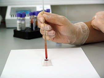 Gloved Hand Dropping Blood Sample onto Microscope Slide
