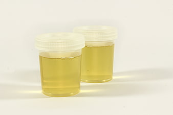 Two plastic specimen containers filled with yellow urine sample on white background