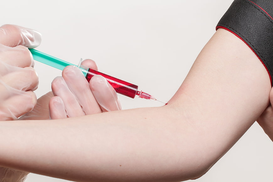 Close-up of blood draw from arm with syringe