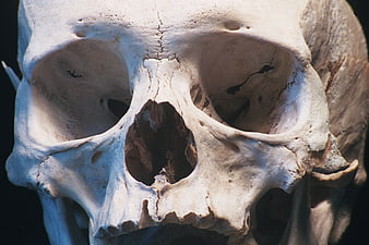 Close-up of Human Skull with Cracks and Textures
