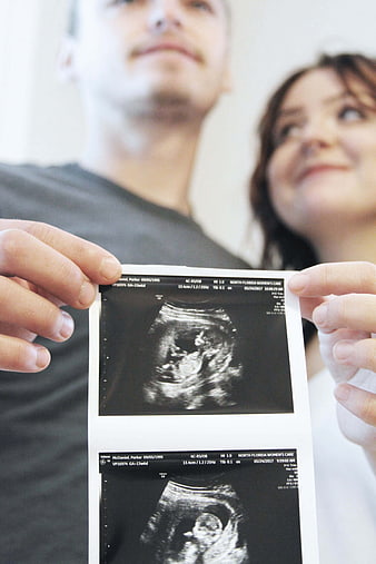 Expectant couple holding ultrasound scan