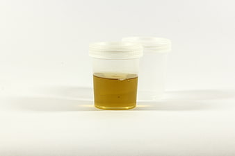 Urine sample in plastic container on white background