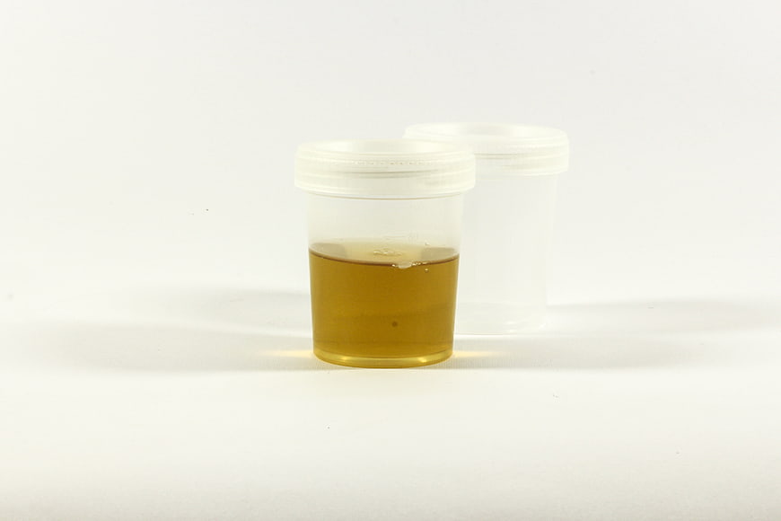 Urine sample in plastic container on white background