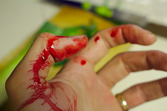Close-up of bleeding hand with cut thumb in kitchen