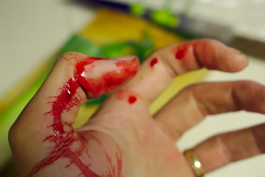 Close-up of bleeding hand with cut thumb in kitchen