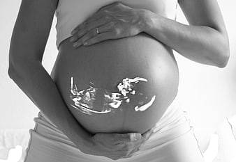 Pregnant woman holding belly with ultrasound gel