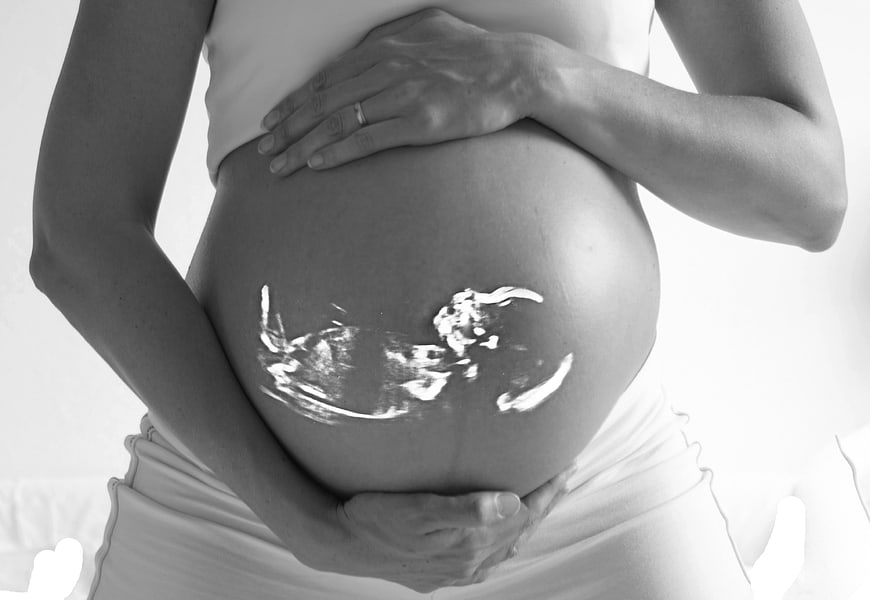 Pregnant woman holding belly with ultrasound gel