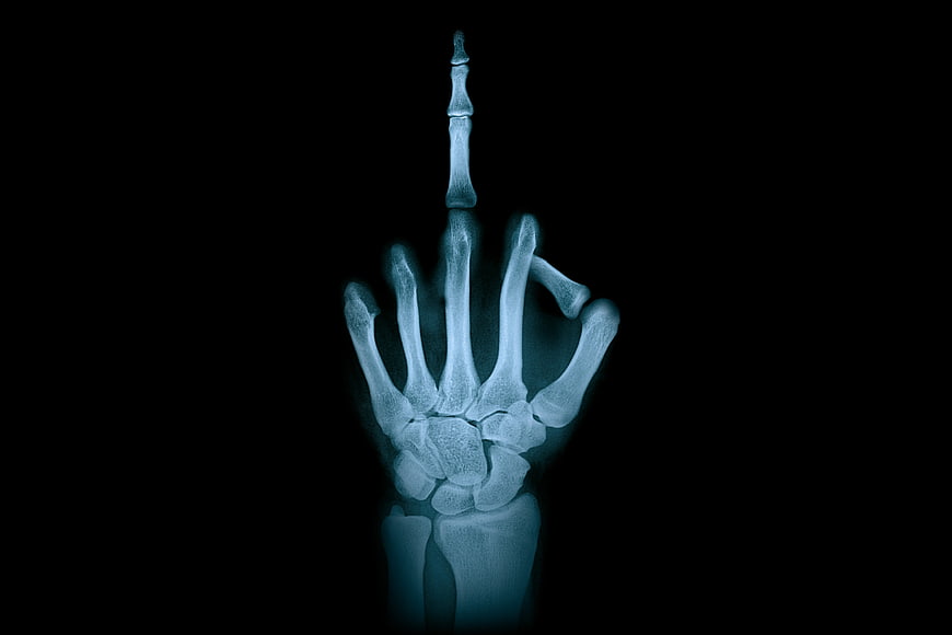 X-Ray of Hand Making Middle Finger Gesture