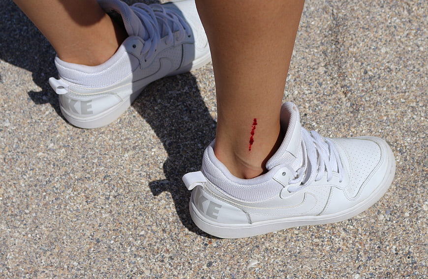 Close-up of woman's ankle with small cut wearing white sneakers