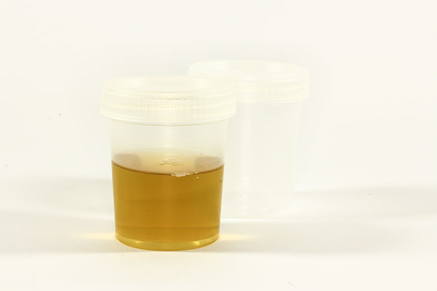 Urine sample in plastic container on white background