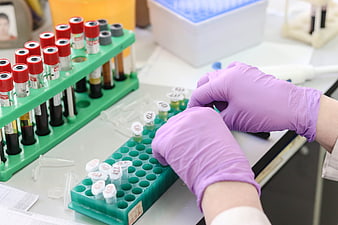 Scientist in purple gloves handling blood sample tubes in a laboratory
