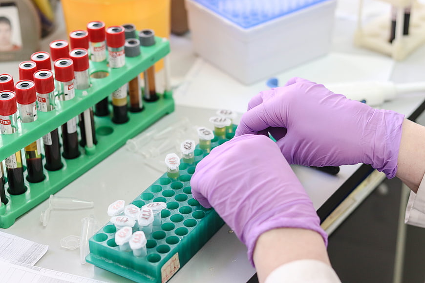 Scientist in purple gloves handling blood sample tubes in a laboratory
