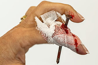 Close-up of a bandaged finger with a nail piercing through the skin