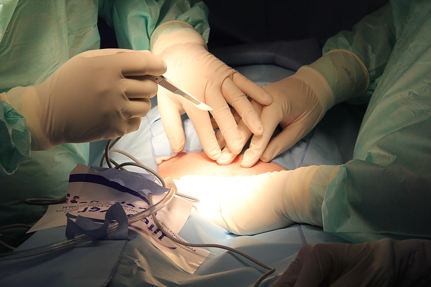 Close-up of surgical procedure with gloved hands and scalpel